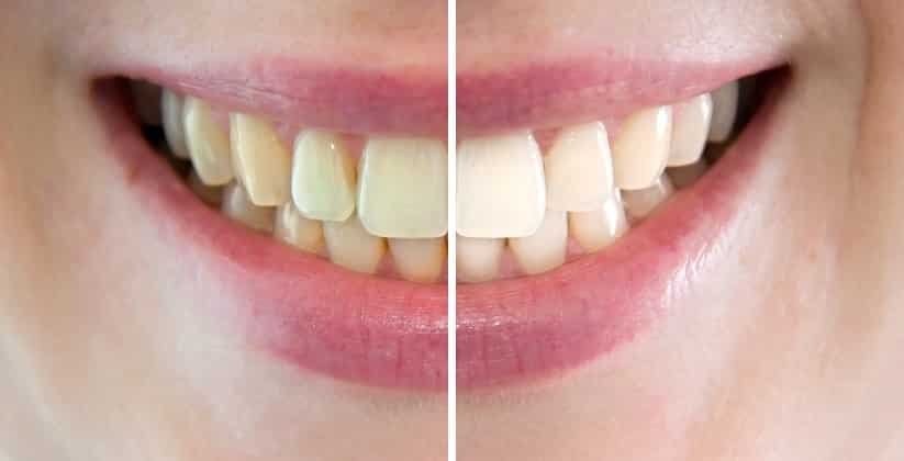 CMD + I Centre de Médecine Dentaire et d'Implantologie, Dr Rossier